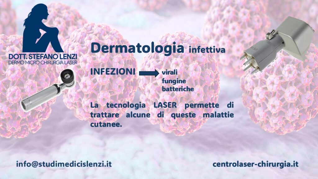 In dermatologia infettiva il LASER per verruche e condilomi